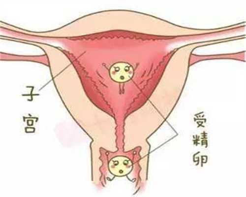 代孕哪家最便宜_代孕在究竟哪些州合法_妊娠早期子宫内膜厚度正常