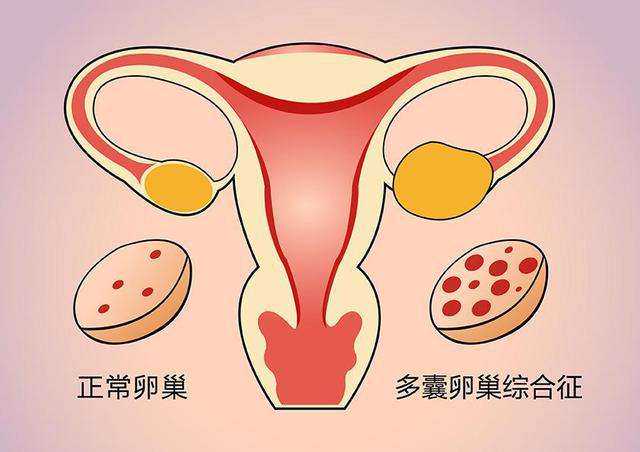 去代孕还行吗_做人工授精代孕的地方_泰国试管婴儿胚胎级别如何分辨？