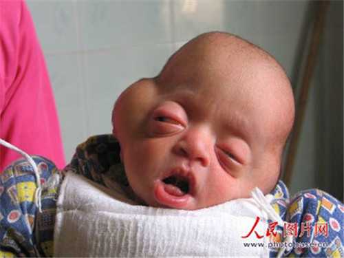南昌试管代生去 南昌妇幼保健院试管费用明细表： ‘怀女儿的孕囊形状图片’